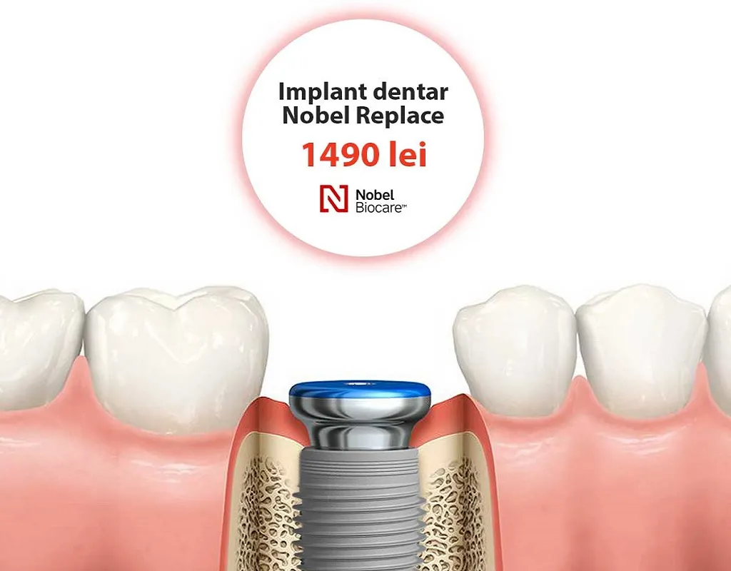 3 Dentocare Antreprenorinromania.ro 002